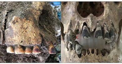 Comparação de resíduos dentários possivelmente resultantes de diferentes práticas: (a) manchas marrom-avermelhadas em dentes de Gua Harimau, Sumatra (cortesia do Prof. Truman Simanjuntak; fotografia por Hsiao-chun Hung); (b) uma camada de pigmento preto em dentes de Dong Xa, Vietnã (Amostra nº 3: 04DXMPK). Crédito: Archaeological and Anthropological Sciences (2026). DOI: 10.1007/s12520-025-02366-5.