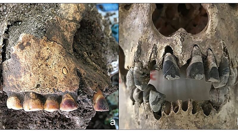Comparação de resíduos dentários possivelmente resultantes de diferentes práticas: (a) manchas marrom-avermelhadas em dentes de Gua Harimau, Sumatra (cortesia do Prof. Truman Simanjuntak; fotografia por Hsiao-chun Hung); (b) uma camada de pigmento preto em dentes de Dong Xa, Vietnã (Amostra nº 3: 04DXMPK). Crédito: Archaeological and Anthropological Sciences (2026). DOI: 10.1007/s12520-025-02366-5.