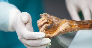 A múmia do Homem do Gelo é preservada em uma câmara refrigerada mantida a uma temperatura constante de -6 °C e umidade relativa do ar de 99%. Crédito: Museu de Arqueologia do Tirol do Sul / Eurac Research / Marion Lafogler.