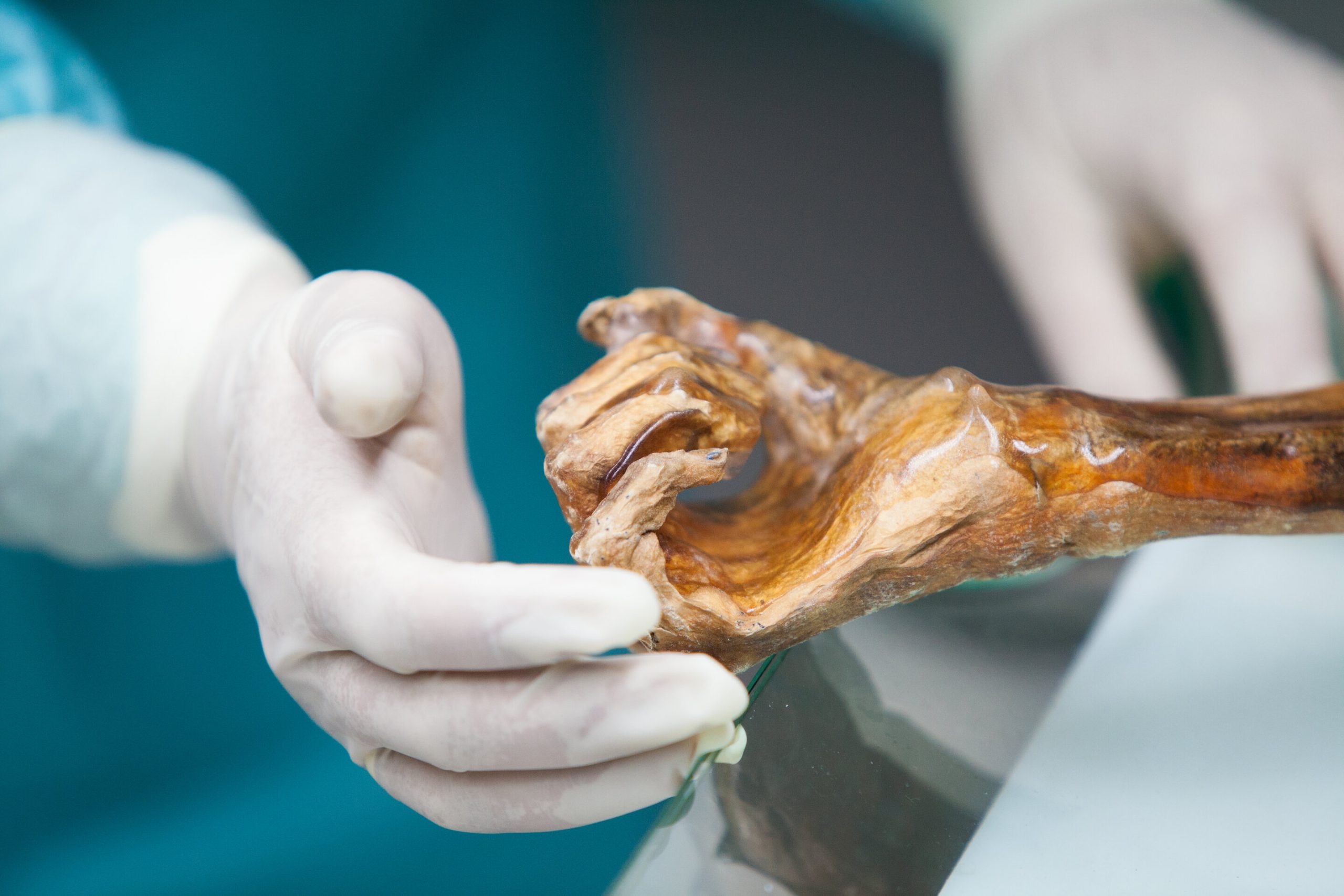 Microrganismos de Ötzi revelam como o microbioma humano mudou ao longo de 5.300 anos