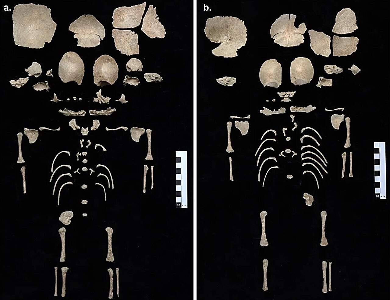 Bebês da Antiguidade, possivelmente gêmeos, encontrados em latrina de 1.200 anos